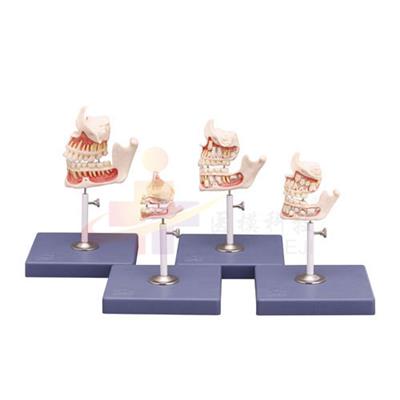 牙齿发育模型
