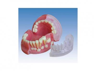 三岁乳恒牙交替解剖模型KY0035