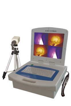 红外乳腺检查仪 （便携式分析打印）EK—9000C型