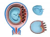 胎儿胎膜与子宫关系模型  XM-826