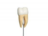 磨牙模型 磨牙解剖放大模型  XM-910