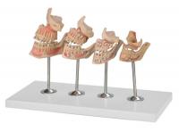 牙齿发育顺序模型 牙与颌骨的发育模型  XM-913