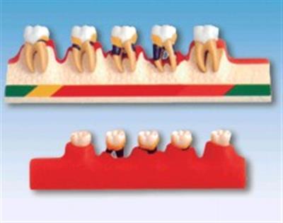 牙周病分类模型HK-L1010