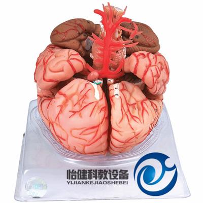 脑动脉模型YJ-A18220