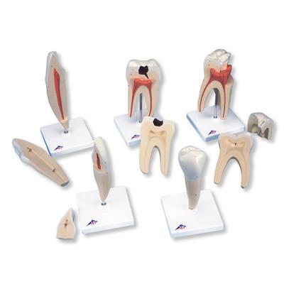经典牙齿模型系列(5种模型)