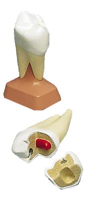 上颌两根龋臼齿模型(2部分)-VE299