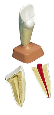 上颌切齿模型(2部分)VE300