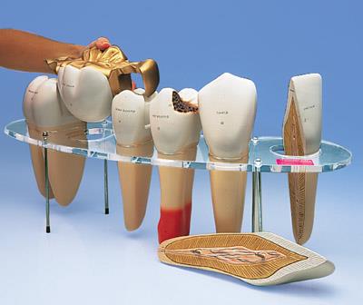 齿科形态学系列模型(实物的10倍)7部分W42528