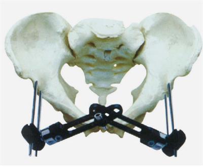 骨盆骨折B型