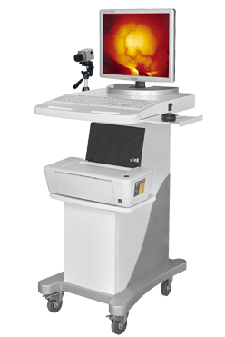 电脑彩色乳腺诊断仪（推车式）EK-9000D型