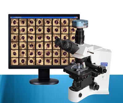 血细胞图像自动分析仪