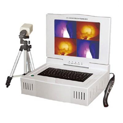 红外乳腺检查仪（彩色液晶分析打印） EK-9000C型