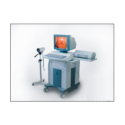 数码电子阴道镜（普通型）CFT-9000型